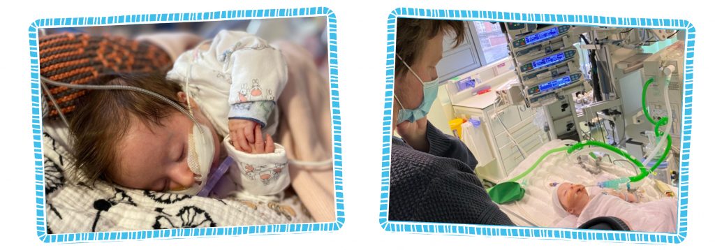 Two images next to each other, each surrounded by a blue ladder frame. On the left, Cleo is asleep on a white and black blanket with tubes in her nose. On the right, Cleo is intubated on a bed in a hospital room while Charlie, her dad is wearing a mask and looking down at her.